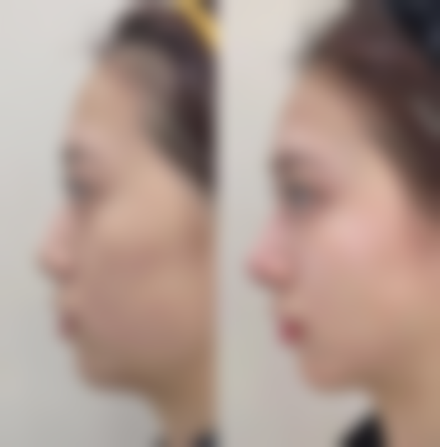 八、佳木斯市妇幼保健院整形美容美体中 心预约挂号方式及流程