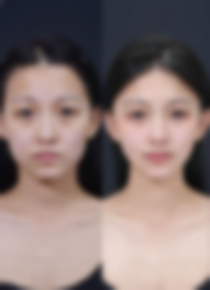 六、佳木斯市妇幼保健院整形美容美体中 心收费价格表