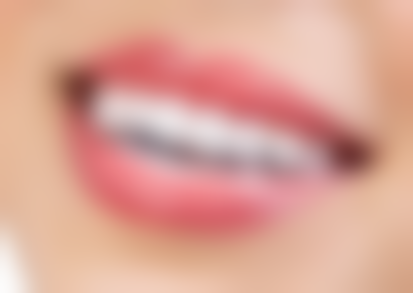 洗牙在防止牙齿变黄方面的作用