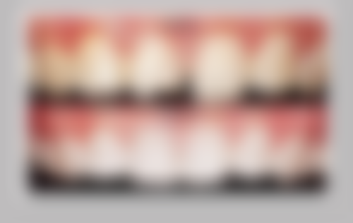 哪些情况不需要做牙套