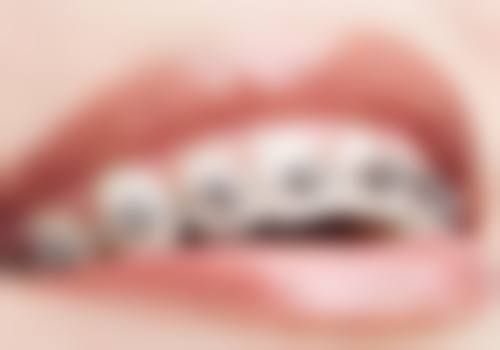 补牙后装牙冠走医保吗？通常不行，属于美容修复类，仅基础补牙能走医保