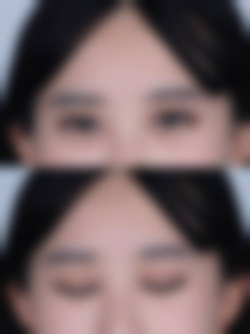 刘长松医生技术优势