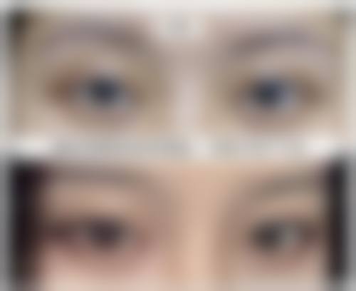 七、陕西安康青美医疗美容医院预约挂号方式及流程