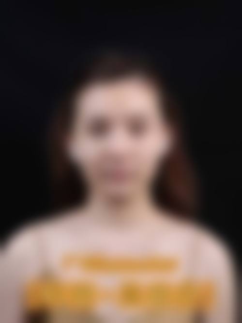 黄思谦医生技术优势