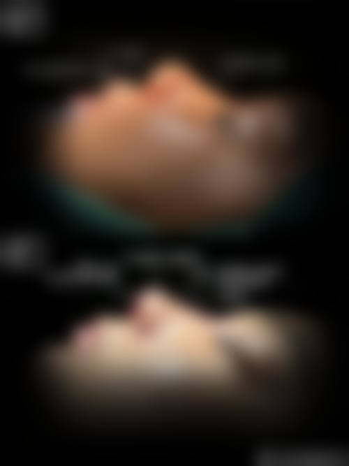 刘长松医生擅长项目