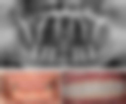 {北京钛植口腔种牙价格：单颗3680元起，半口5.5万起，瑞士ITI8980元起