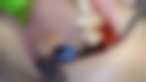 整形项目分类价目表