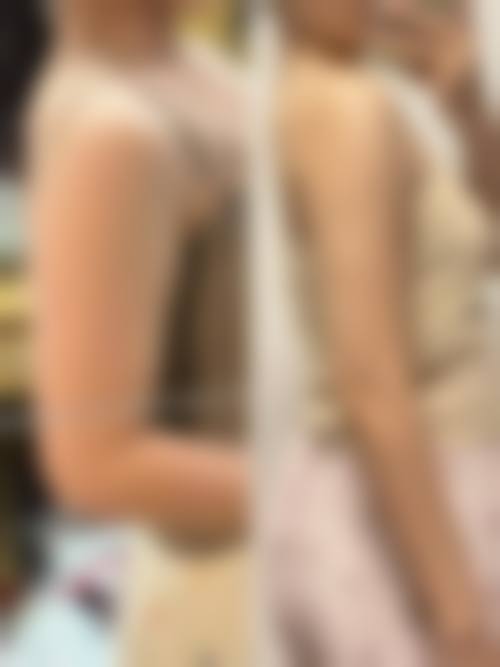 六、郑州大桥医院医疗美容科口碑怎么样？