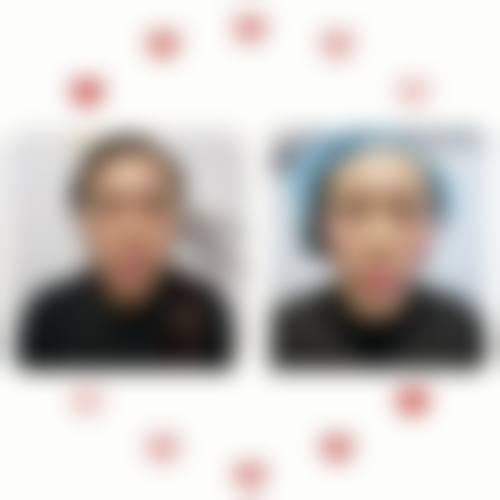 李東畇医生擅长项目