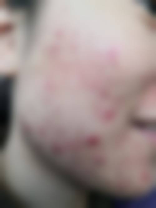 王万学医生技术优势