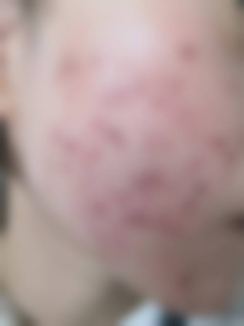 王万学医生擅长项目