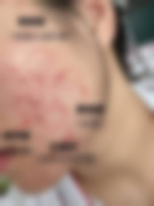 王万学医生口碑评价