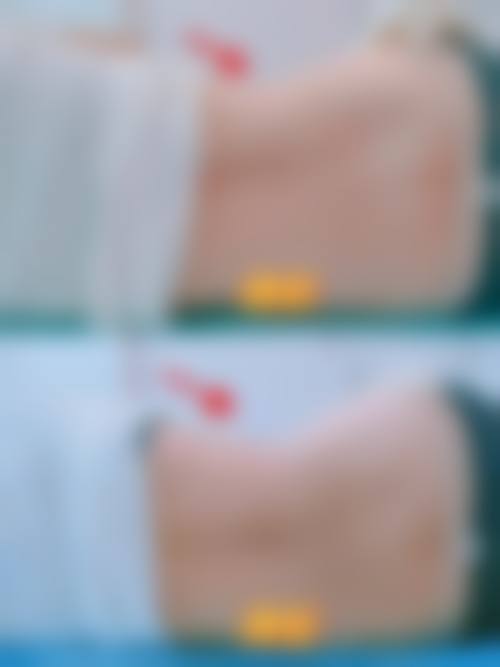 七、韩国我们整形外科口碑怎么样？