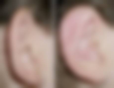 侯涛医生技术优势