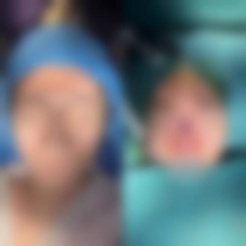 谢慧慧医生擅长项目