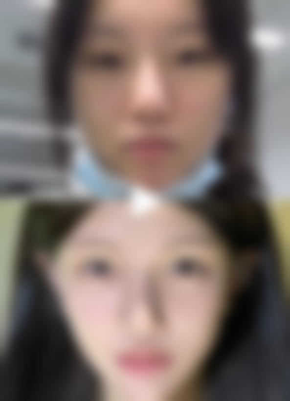 七、鞍山铁东区菲之都整形医院口碑怎么样？