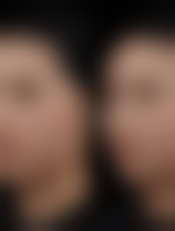 四、鞍山铁东区菲之都整形医院特色项目及技术优势