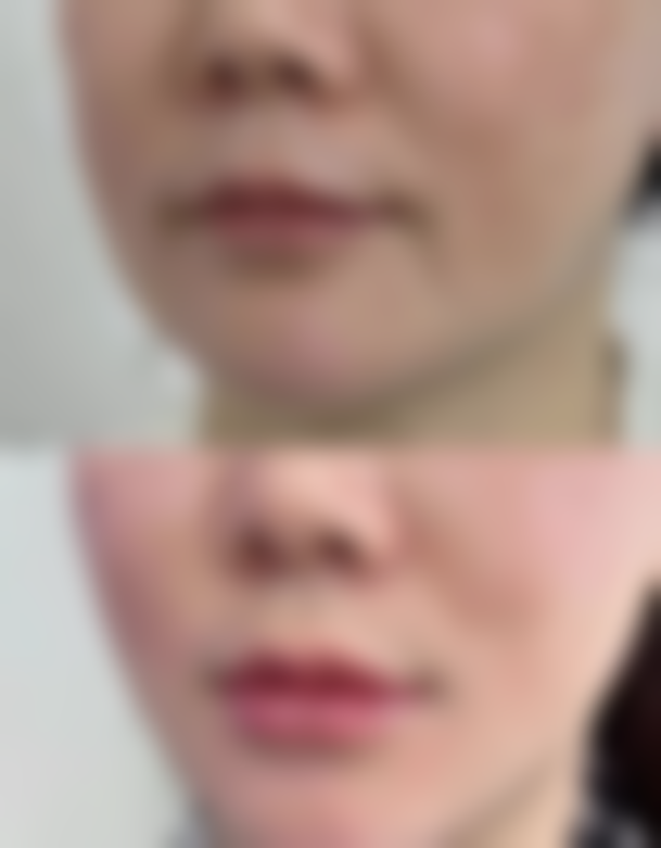 周红利医生口碑评价