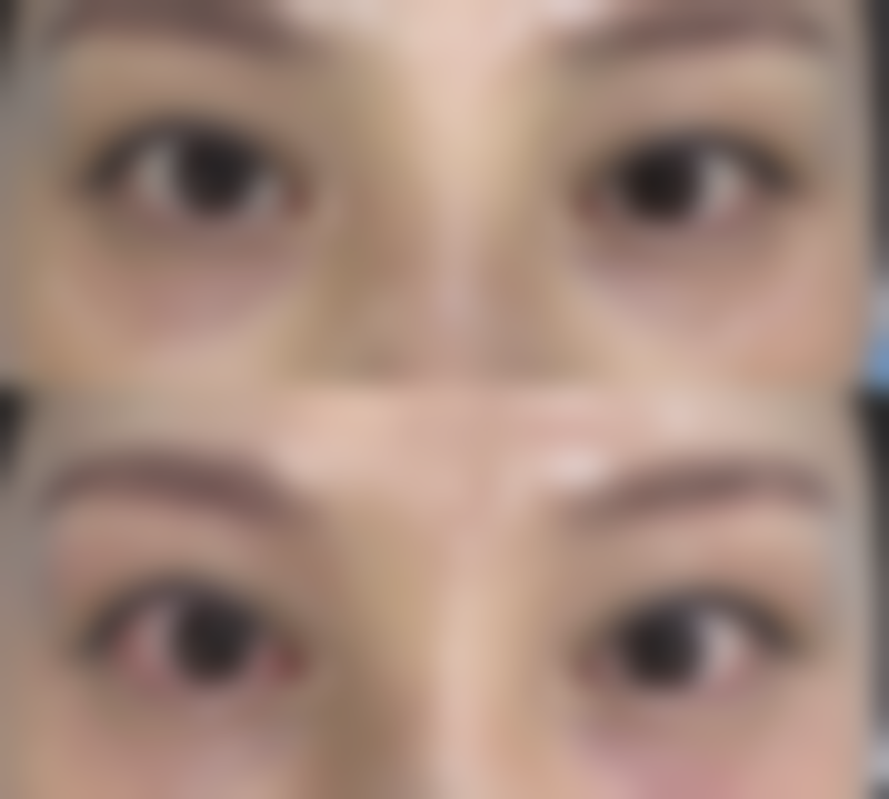 六、北京医龄慕颜医疗美容诊所口碑怎么样？