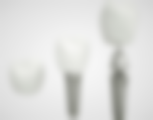 哪些情况建议摘下已粘好的烤瓷牙