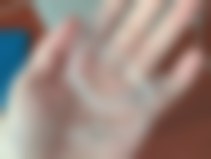 如何缓解第一次根管治疗后的疼痛？