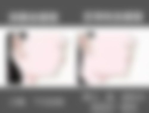 不同地区瑞士种植牙价格差异分析