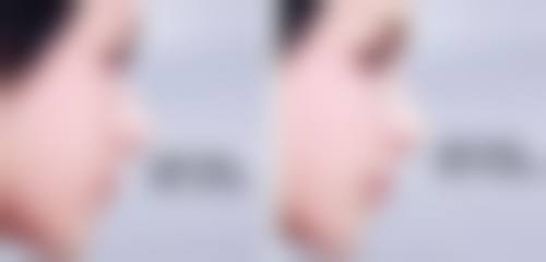 河北大学附属医院孟杰医生荣誉资质