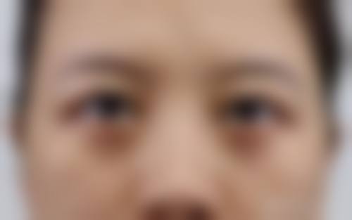 三、廊坊城南医院整形美容科特色项目及技术优势