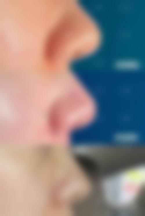 八、阜阳皮肤病医院预约挂号方式及流程