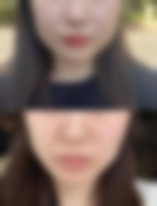 四、浙江宁波美莱整形医院特色项目及技术优势