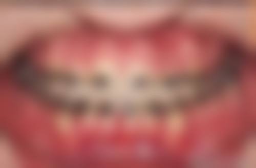 骨干医生对接的保护