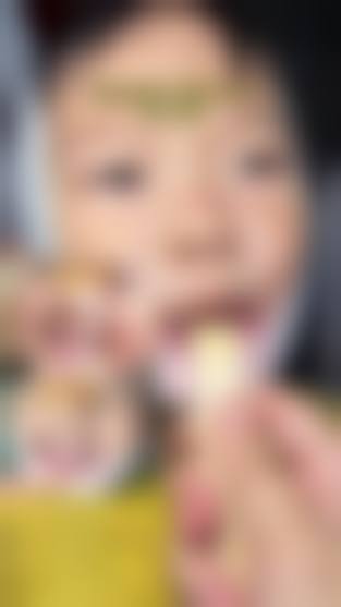 9 - 12岁恒牙早期：地包天矫正的末尾机会期