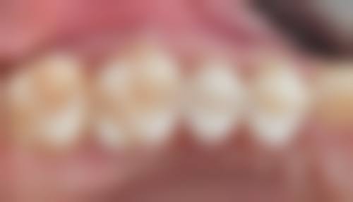 （三）其他口腔项目