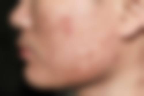 四、阜阳皮肤病医院特色项目及技术优势