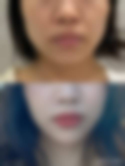 四、成都艺美医疗美容门诊部收费价格表