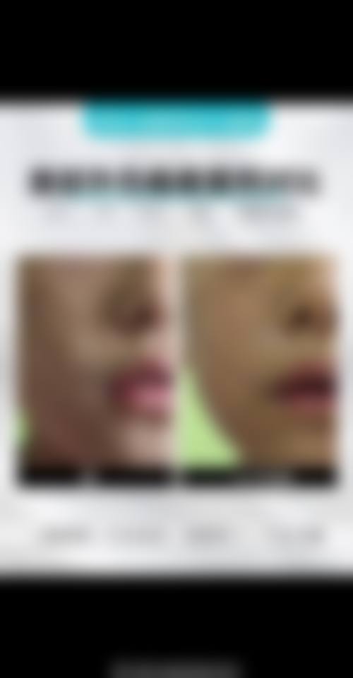 二、韩国世现Sehyeon整形医院是正规医院吗