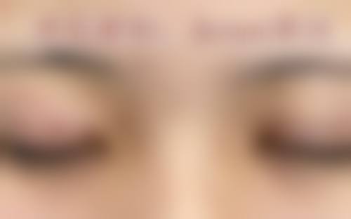 邢继霞医生技术优势