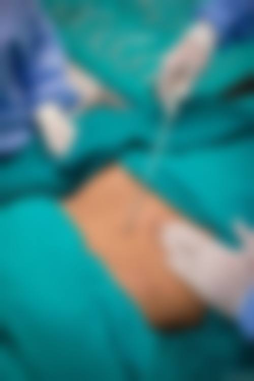 五、廊坊城南医院整形美容科口碑怎么样？