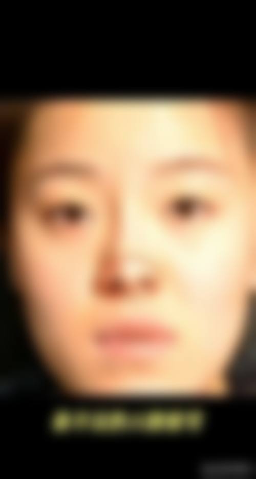 四、廊坊城南医院整形美容科收费价格表