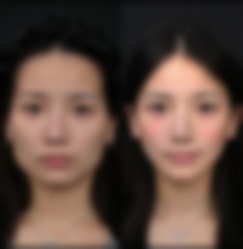 六、商丘颜小柒医疗美容诊所口碑怎么样？