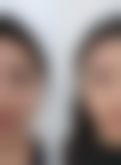 二、北京嘉和医疗美容医院是正规医院吗？