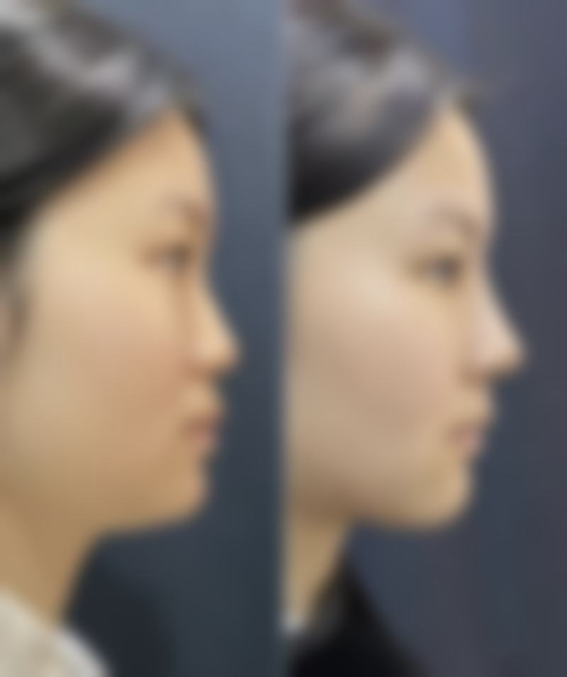 三、韩国世丽（seri）整形医院地址电话营业时间