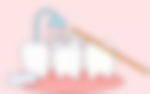 补牙后酸疼多久消失？一般1-2周缓解，超2周未愈需警惕继发龋或咬合问题