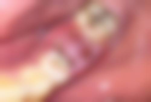 五、呼和浩特美莱整形专科医院收费价格表