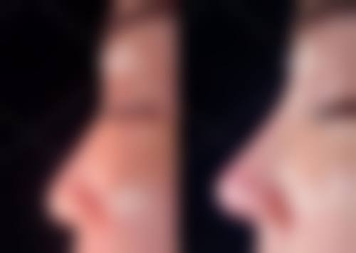 七、深圳南山区人民医院整形美容科口碑怎么样？