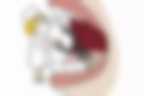 专精治疗建议：重度情况需及时就医