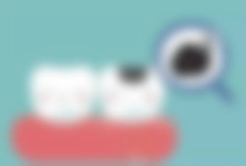 （一）种植牙项目