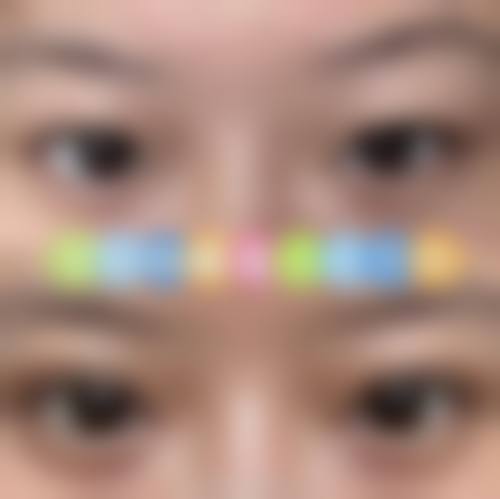 六、烟台宝菲整形医院口碑怎么样？