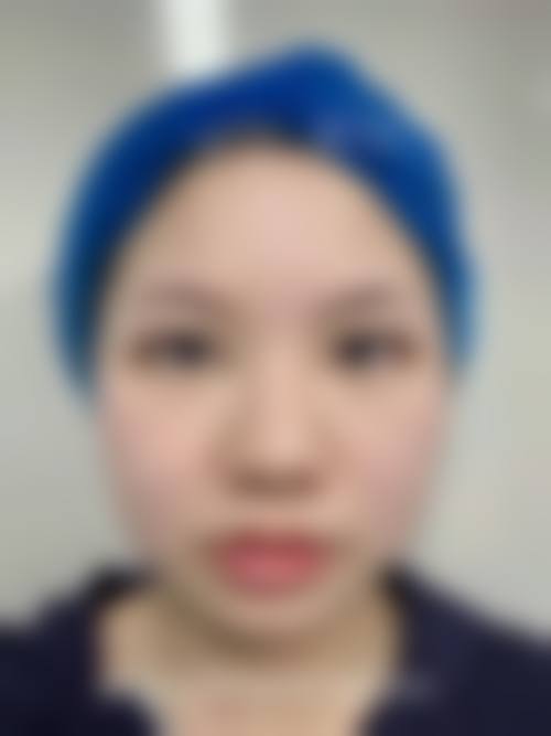 六、肇庆柏悦医疗美容门诊部收费价格表