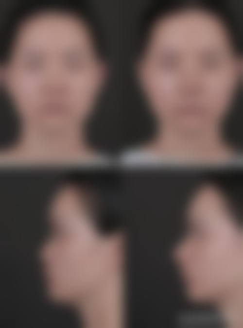 五、重庆奥普恩整形医院收费价格表